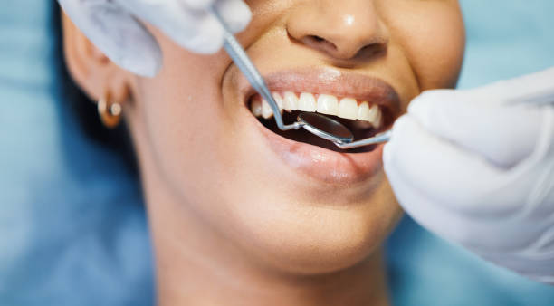 Best Cosmetic Emergency Dentistry in Belleair Beach, FL